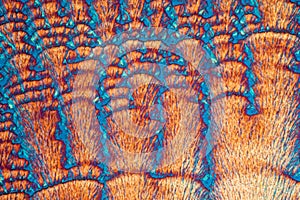 Picture of the crystals of the chemical substance Ascorbicacid, vitamin C, made by a microscope in polarized light