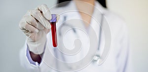 The picture of doctor`s hand holding blood tube coronavirus test