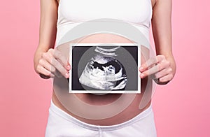 Picture of ultrasound with a baby in the hands of a pregnant girl