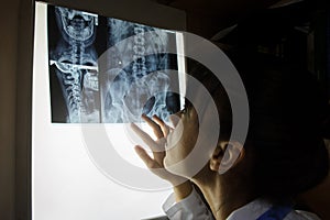 Picture of a woman doctor exploring spinal x-ray: lumbar and cervical region photo