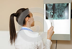 Picture of a woman doctor exploring spinal x-ray: lumbar and cervical region photo