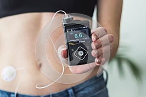 Woman holding an insulin pump photo