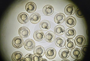 Picture of zebra fish embryo under microscope.