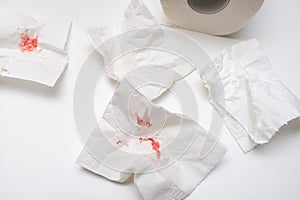Pieces of toilet paper with a blood, anal bleeding concept