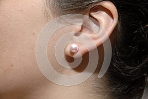 Pierced Ear photo