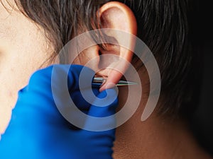 Piercing and stretching the ears with medical  blue gloves. increase the diameter of the ear tunnels