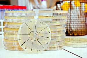 Pile of agar plates