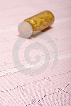 Pills on ECG chart (ECG results)