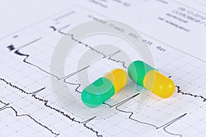 Pills on ECG diagram