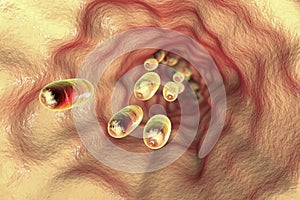 Pills in oesophagus