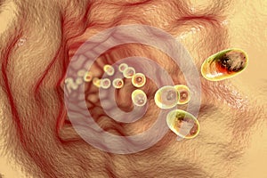 Pills in oesophagus