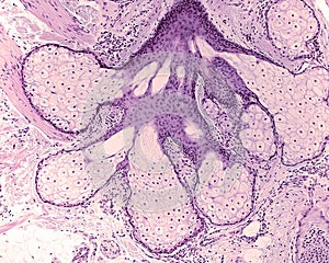 Pilosebaceous unit. Sebaceous gland