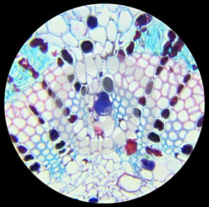 Pine needle cross-section under the microscope, background