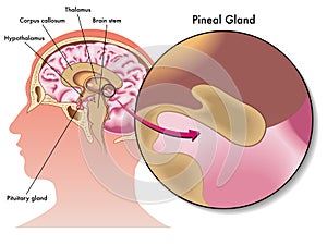 Pineal gland photo