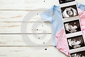 Pink and blue baby romper and ultrasound on white wood photo