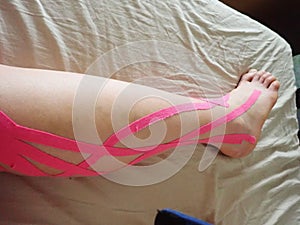 lymfatic tape on a leg after operation