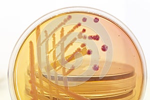 Pink and yellow bacterial culture on agar with other dishes in the background