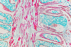 Pinus Male Strobile- cell microscopic