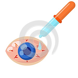 Pipette and eyedropper. Red eye disease. Medicine for blood vessels and Allergy Problems