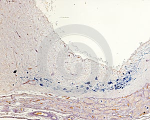 Pituitary stalk. Neurosecretion