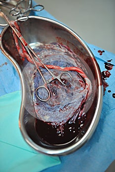 Placenta photo