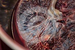 Placenta birthed at home photo