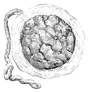 Placenta external or uterine side, vintage engraving
