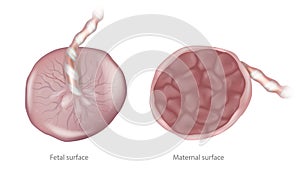 Placenta Maternal surface and Fetal surface. Biology of the Human Placenta photo