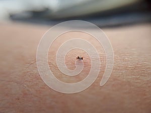 Plague ticks. Lyme disease