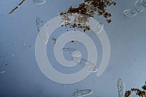 Plankton with microscopic ciliates