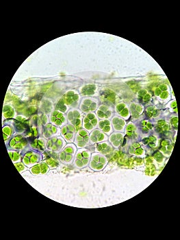 Plant cell with chloroplast under microscope