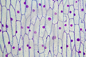 Plant mitochondria photo