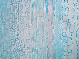 Plant stem, long section