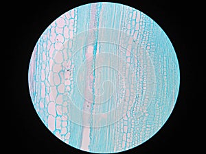 Plant stem, long section