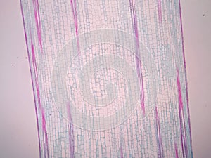 Plant stem, long section