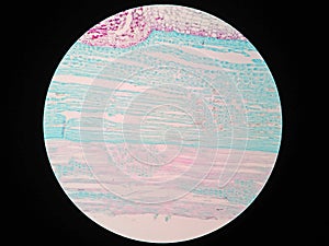 Plant stem, long section