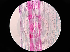 Plant stem, long section