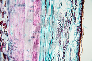 Plant Stem under the microscope for classroom education.