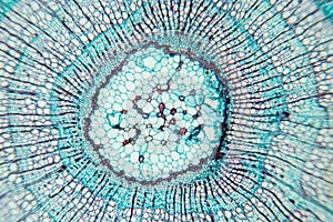 Plant Stem under the microscope for classroom education.