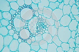 Plant Stem under the microscope for classroom education.