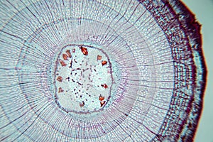 Plant Stem under the microscope for classroom education.