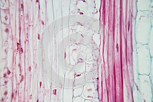 Plant Stem under the microscope for classroom education.