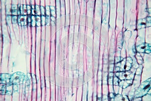 Plant Stem under the microscope for classroom education.