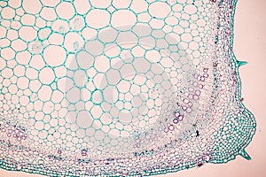 Plant tissues under the microscope in the laboratory.