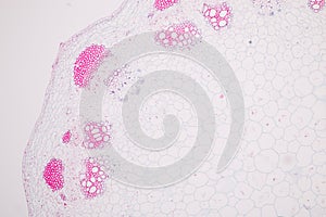 Plant tissues under the microscope in the laboratory.