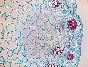 Plant tissues under the microscope in the laboratory.