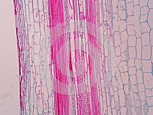 Plant vascular tissue