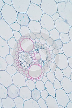 Plant vascular tissue under microscope view