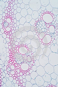 Plant vascular tissue under microscope view