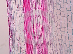 Plant vascular tissue photo